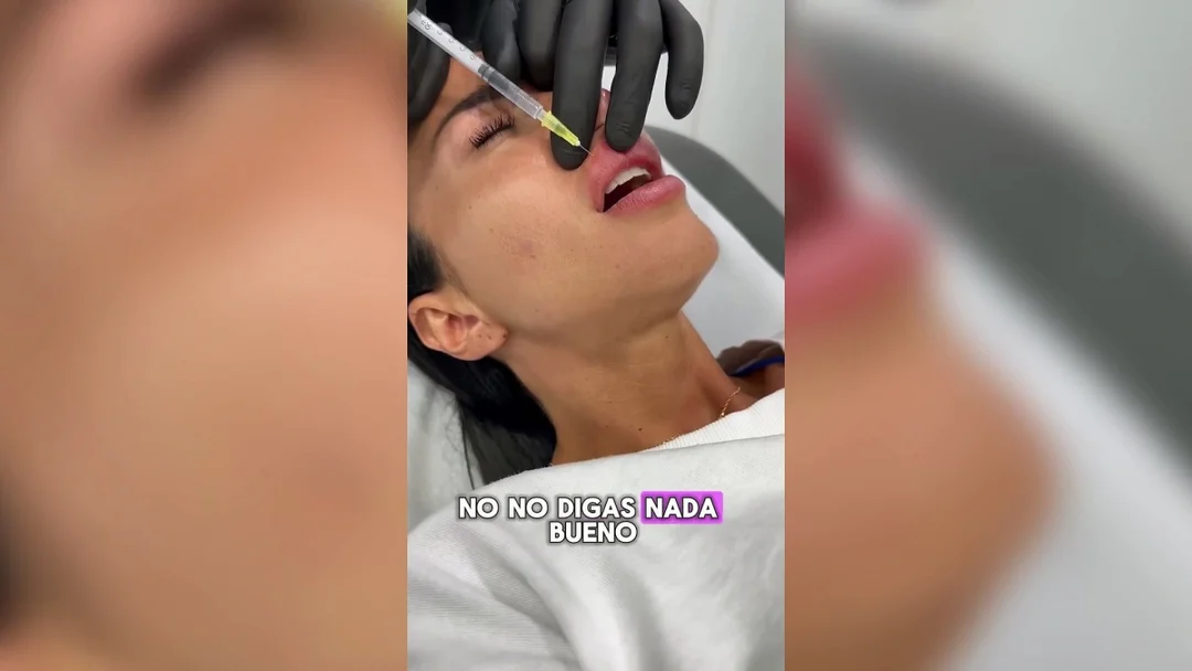 ¿El Antes y Después de Aurah Ruiz? La Influencer Se Libera de su Pasado Estético